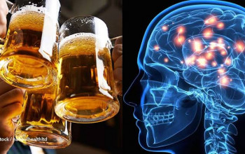 Estudo mostra que beber cerveja pode diminuir o tamanho do cérebro